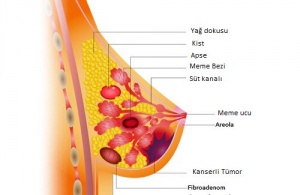 Kanseri Önlemeye Yardımcı Yiyecekler