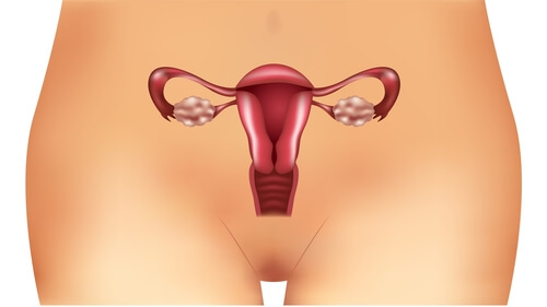 Ovario-poliquistico