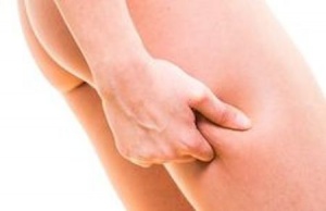 Selülite Karşı Mücadelede Yapılması Gerekenler