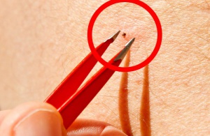 Keneler: Hayvanlar ve İnsanlar için Tehlike