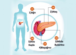 Pankreas Hastalıklarının 6 Belirtisi