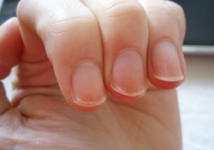 Tırnaklara Bakarak Sağlık Durumu Anlaşılabilir