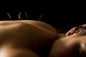 kadın sırtı akupunktur
