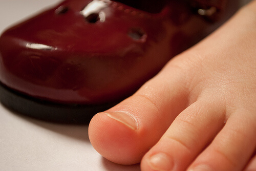 tırnak batmasını önlemek