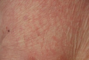 Cilt ve Sağlık Durumunuz Arasındaki İlişki