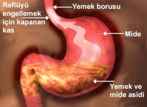 Reflü Hastalarına Uygun Gıdalar