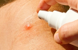 Ev Yapımı Sivrisinek Kovucular