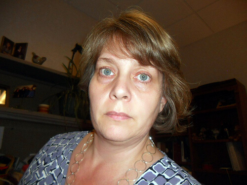 göz altı torbaları doğal tedavi