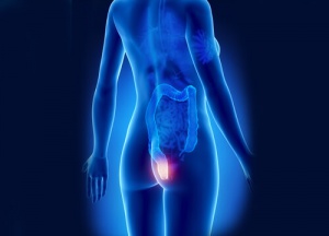 Hemoroidi Zamanında Teşhis Edin