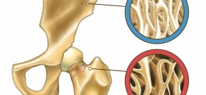 Osteoporozu Önlemek İçin Doğal Yollar