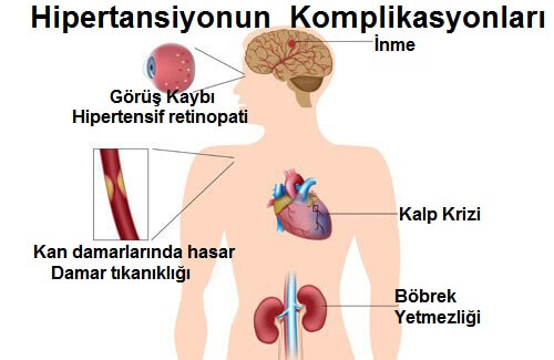 Yüksek Kan Basıncıyla Savaşta En İyi Yöntemler