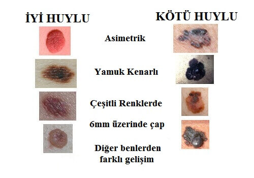 iyi huylu ve kötü huylu benler