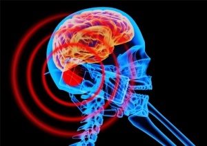 Elektromanyetik Alan Nedir ve Sizi Nasıl Etkiler?