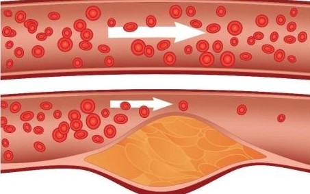 kolesterol kan akışı