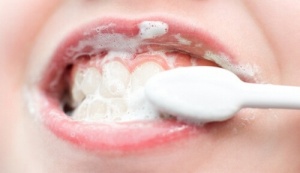 Dişleri Beyazlatmak için Doğal Ev Tedavileri