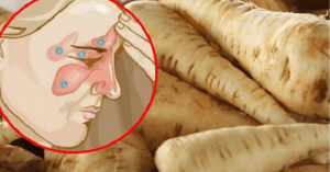 Sinüzitten 5 Günde Nasıl Kurtulursunuz?