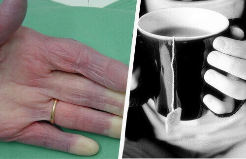 Soğuk Eller: Bilmeniz Gereken Bazı Muhtemel Sebepler