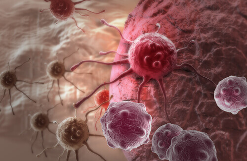 kanserli hücreler