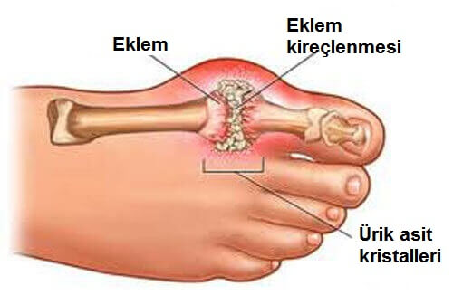 ayaktaki eklemleri gösteren tablo