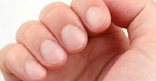 Sağlığınız için 8 Tırnak Alarmı