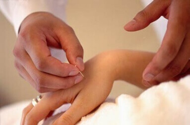 akupunktur yaptırmak