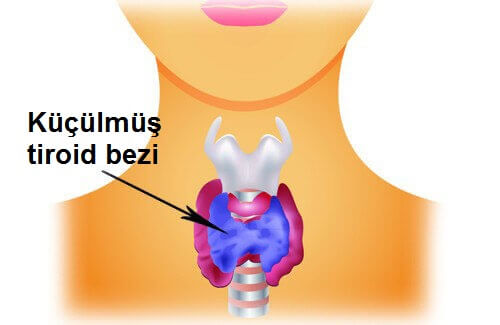 tiroidi düzenlemek