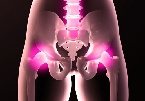 Kalça Ağrıları: Kalçalara İyi Gelmeyen Alışkanlıklar