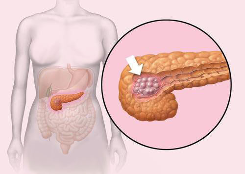Pankreas Sağlığı için Uygulayabileceğiniz İpuçları