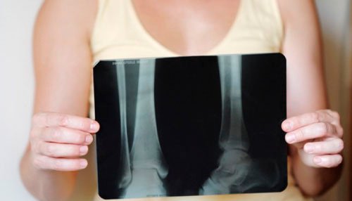 xray