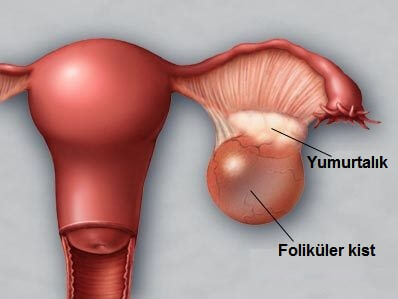 yumurtalık-1