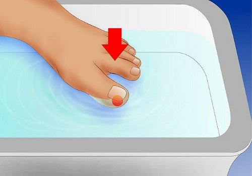 Tırnak Batması Nasıl İyileştirilebilir?