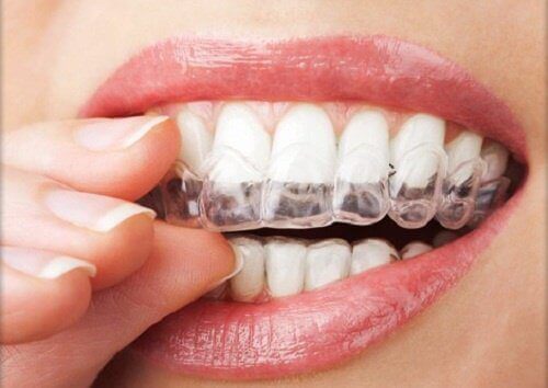 Diş Gıcırdatma ve Çene Sıkmaya 4 Çözüm