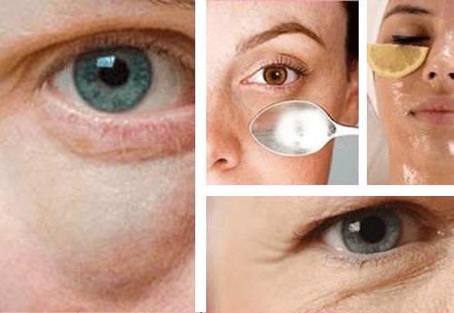 Göz Altı Torbaları ile Savaşmanın Basit Yolları