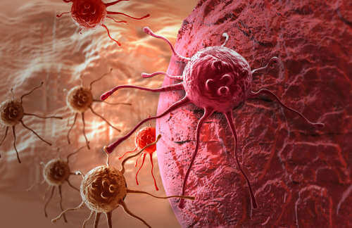 kanser hücreleri rafine şeker