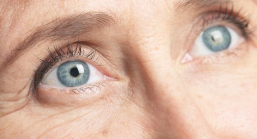 göz kırışıklığı