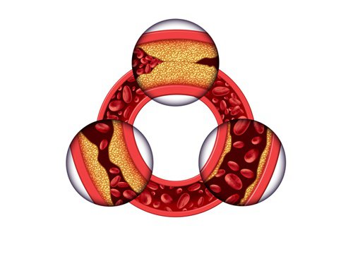 Kolesterolü Düşürmek için Yulaflı 3 Tarif