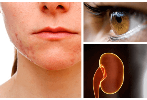 Stresten Etkilenen Organlar ve Nedenleri