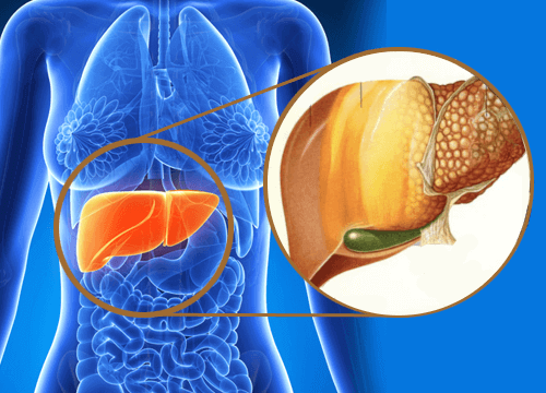 Karaciğer Yağlanması Nasıl Tedavi Edilir?