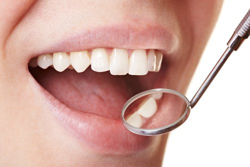 Diş Plağı İçin Evde Uygulayabileceğiniz Yöntemler