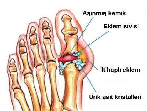 Gut Hastalığı Tedavisinde Doğal Yöntemler