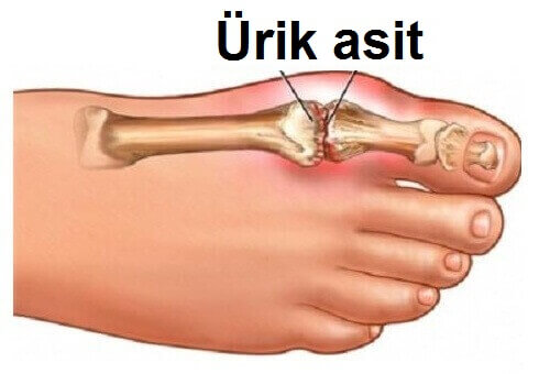 ürik-asit-2