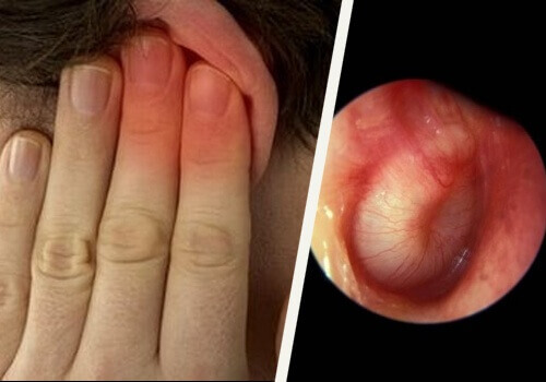 Kulak Enfeksiyonu İçin Tedaviler