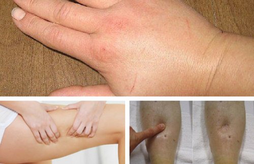 Vücutta Sıvı Tutulmasını Önleyen 8 Doğal Diüretik