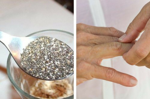 Eklem İltihabı Belirtileri için Beslenme Önerileri