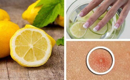 Limonun Güzellik Amaçlı 6 Farklı Kullanımı