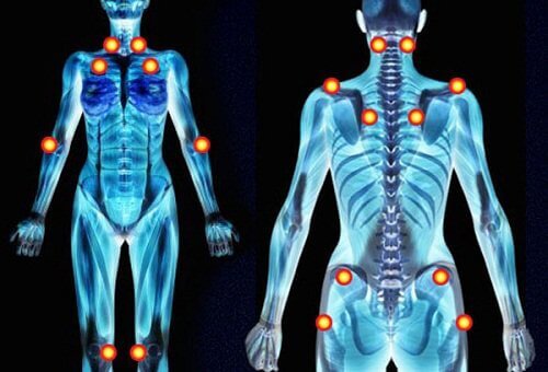 fibromiyalji iskelette belli noktalar