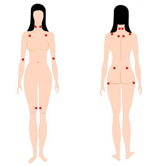 fibromiyalji
