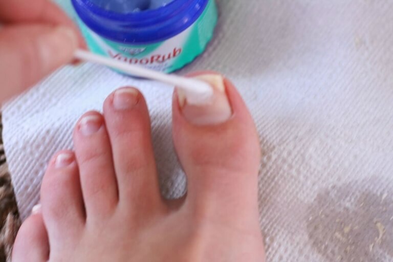 vicks tırnak
