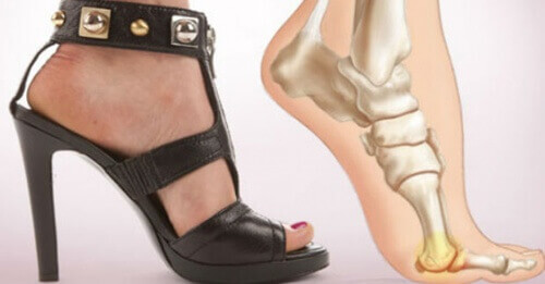 Topuklu Ayakkabı Giymeyi Bırakmak için 5 Neden