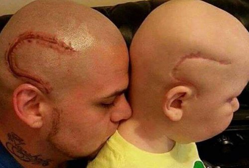"Artık aynıyız." Bir Baba, Oğlunun Yarasını Kendine Dövme Yaptırıyor